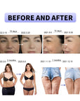 CAVITATION MACHINE