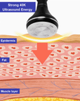 CAVITATION MACHINE